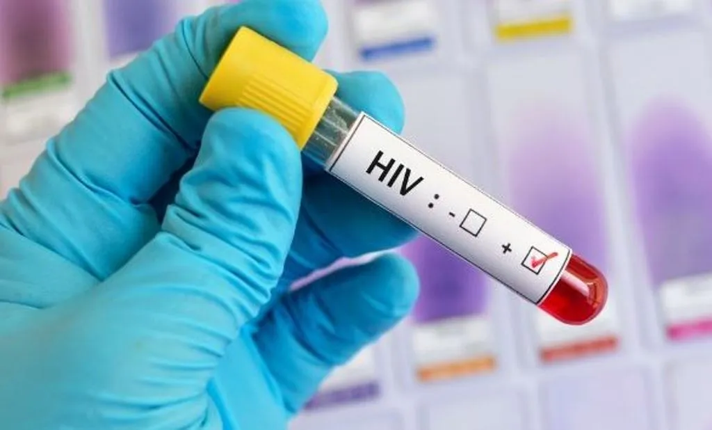अस्पताल में 60 से अधिक प्रेग्नेंट महिलाएं पाई गईं HIV पॉजिटिव,  35 की हुई डिलीवरी, मचा हड़कंप 