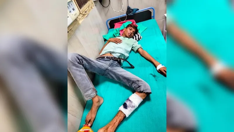 Farrukhabad: हमलावरों ने टैक्सी चालक को मारी गोली, जिला अस्पताल में भर्ती, उधारी न चुकाने पर वारदात को दिया अंजाम