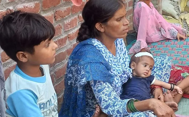 रामपुर: आंगन में सो रही बच्ची को उठा ले गया बंदर, छत से फेंका, सिर में आए 10 टांके 