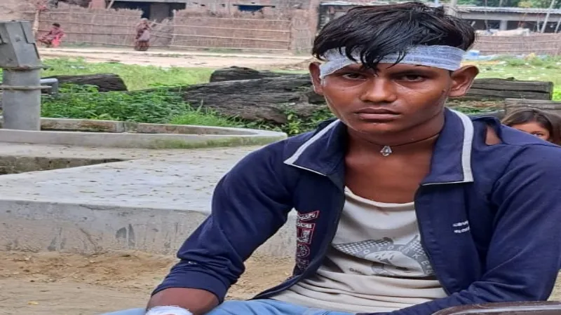 बहराइच : मगरमच्छ के हमले में किशोर घायल, चल रहा इलाज 