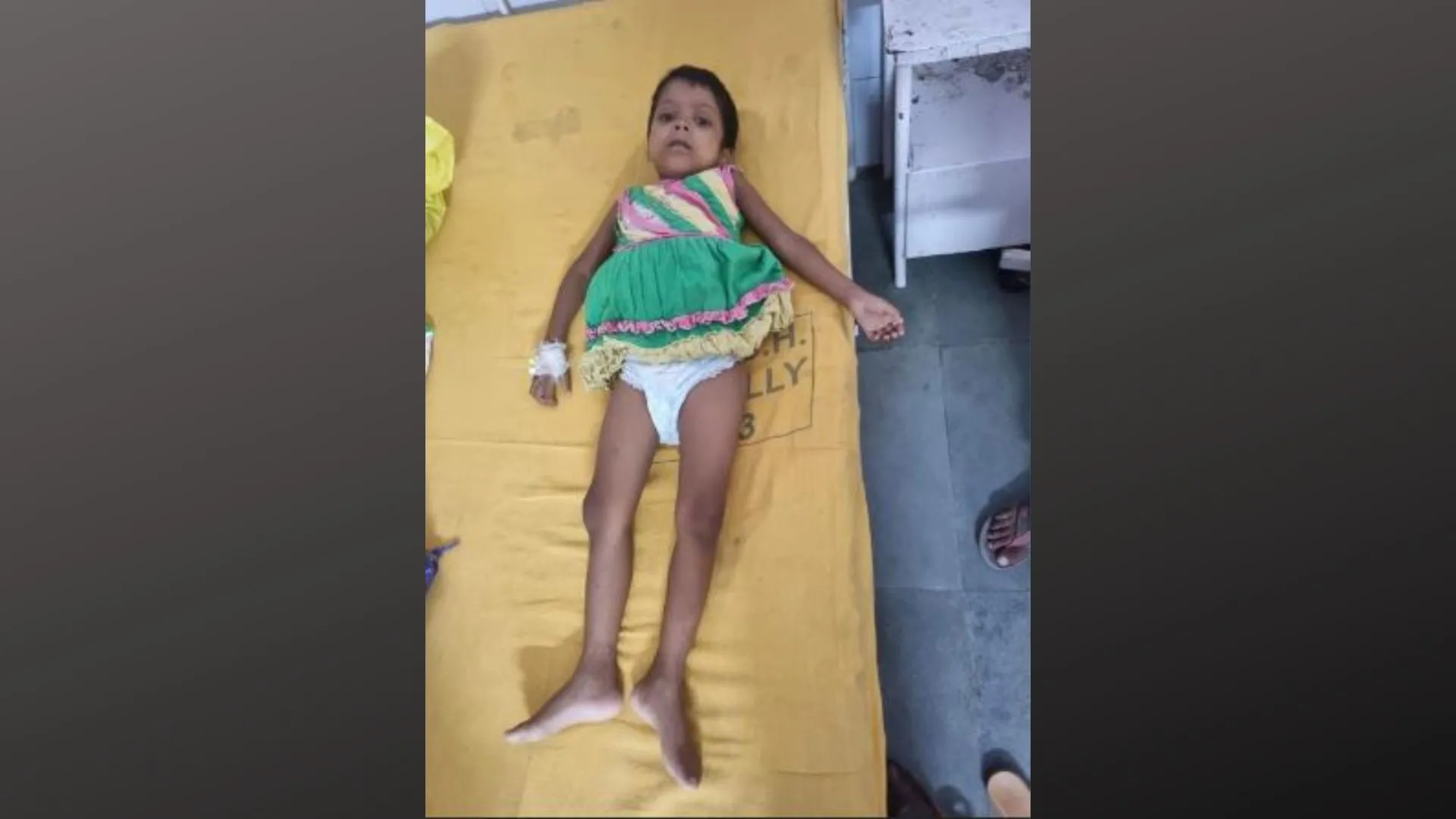 बरेली: समय पर नहीं कराया बुखार का इलाज, 4 साल की बच्ची की दोनों किडनी फेल