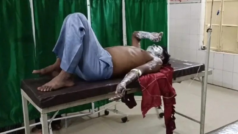 Jalaun News: सिलेंडर में लगी आग, खाना बना रही महिला झुलसी, बचाने में पति भी चपेट में आया, दोनों की हालत गंभीर