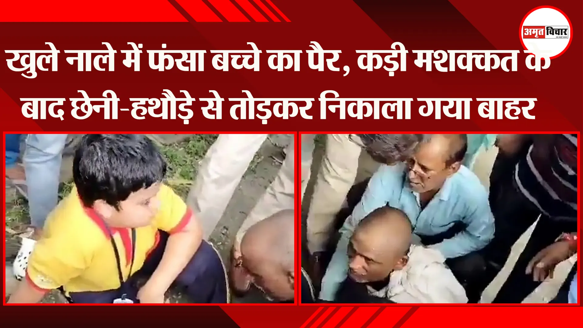 लखनऊ: खुले नाले में फंसा बच्चे का पैर, कड़ी मशक्कत के बाद छेनी-हथौड़े से तोड़कर निकाला गया बाहर