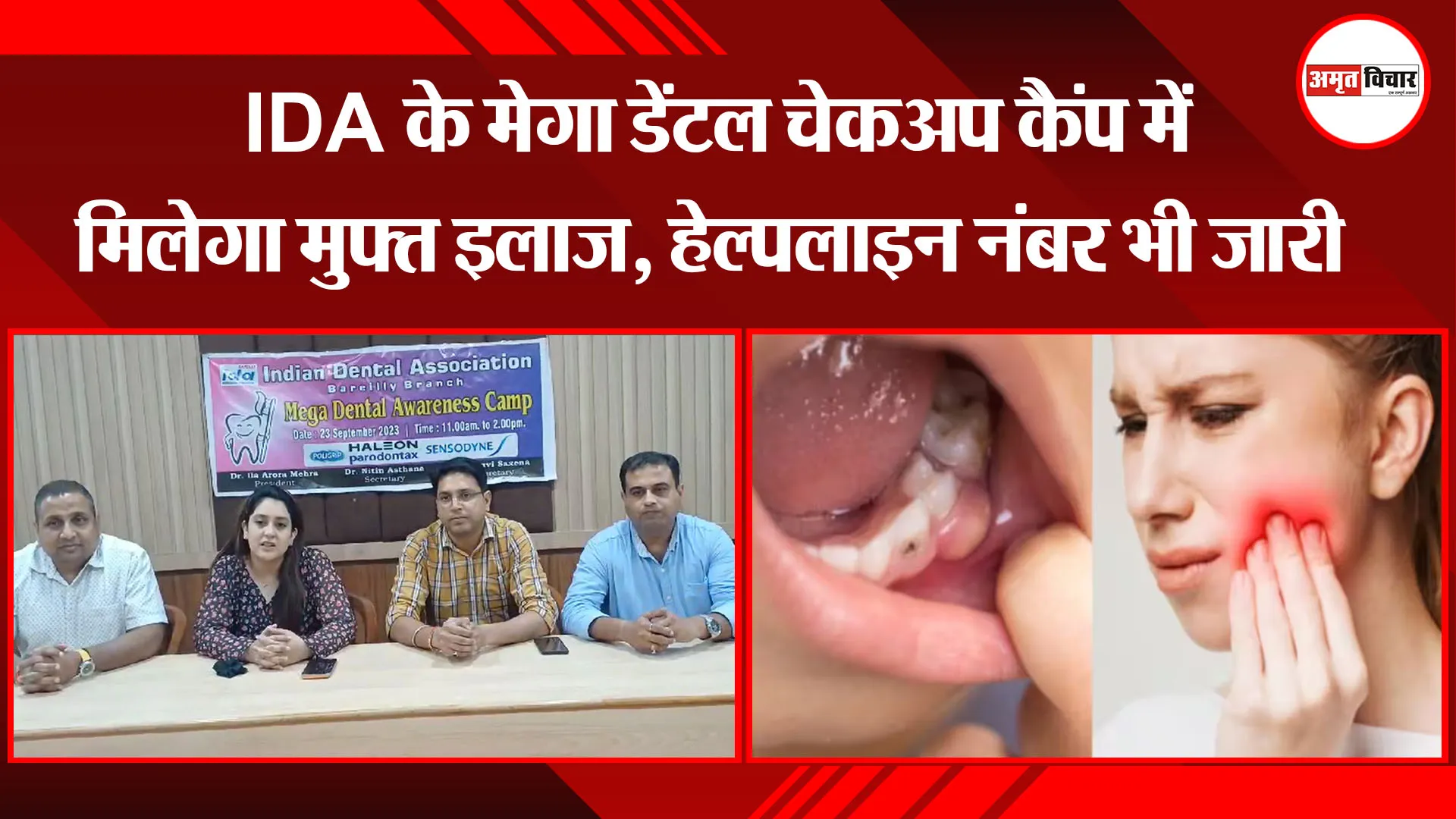 बरेली: IDA के मेगा डेंटल चेकअप कैंप में मिलेगा मुफ्त इलाज, हेल्पलाइन नंबर भी जारी 