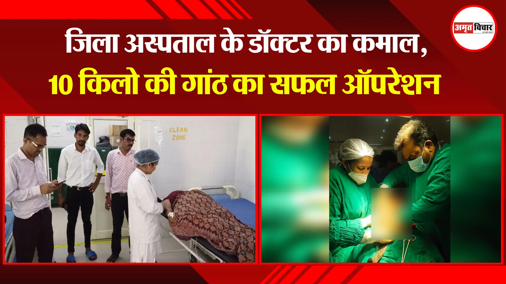मुरादाबाद: जिला अस्पताल के डॉक्टर का कमाल, 10 किलो की गांठ का सफल ऑपरेशन