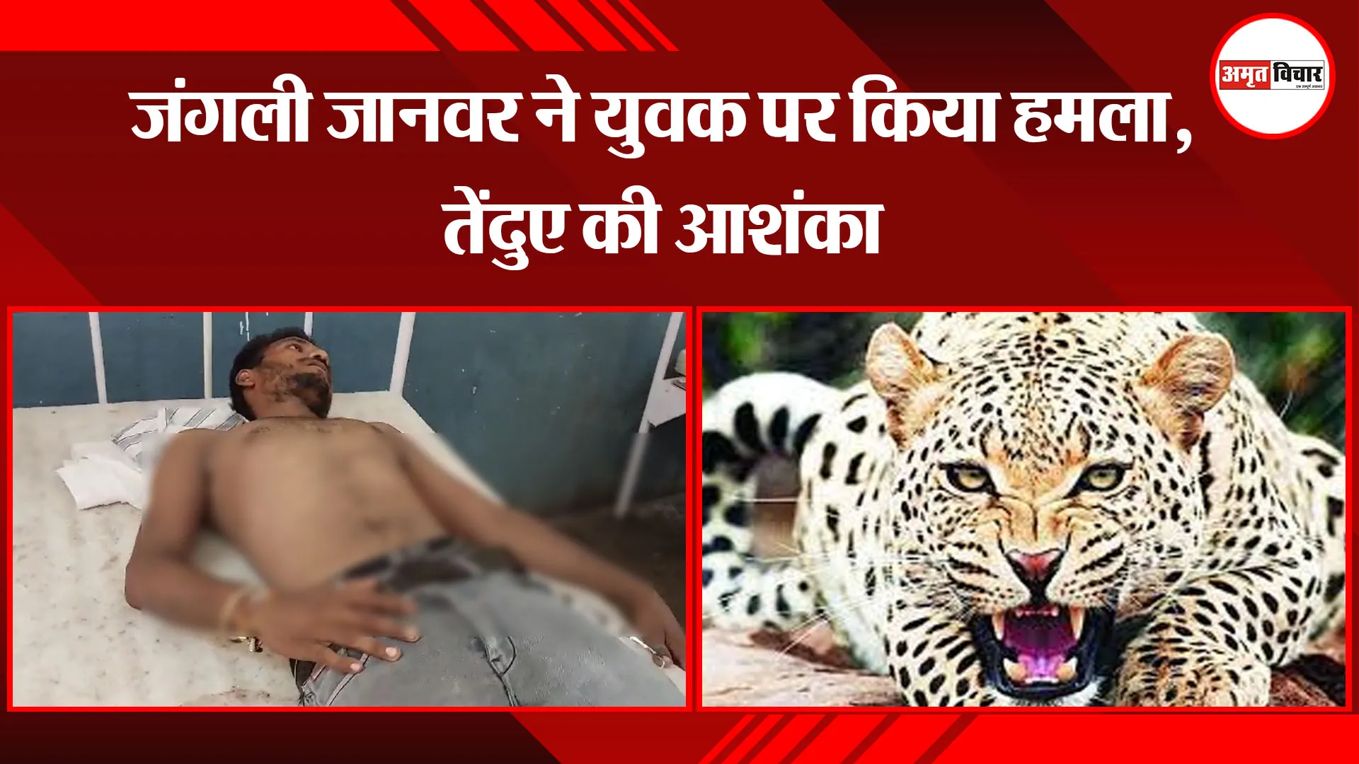 उन्नाव: जंगली जानवर ने युवक पर किया हमला, तेंदुए की आशंका