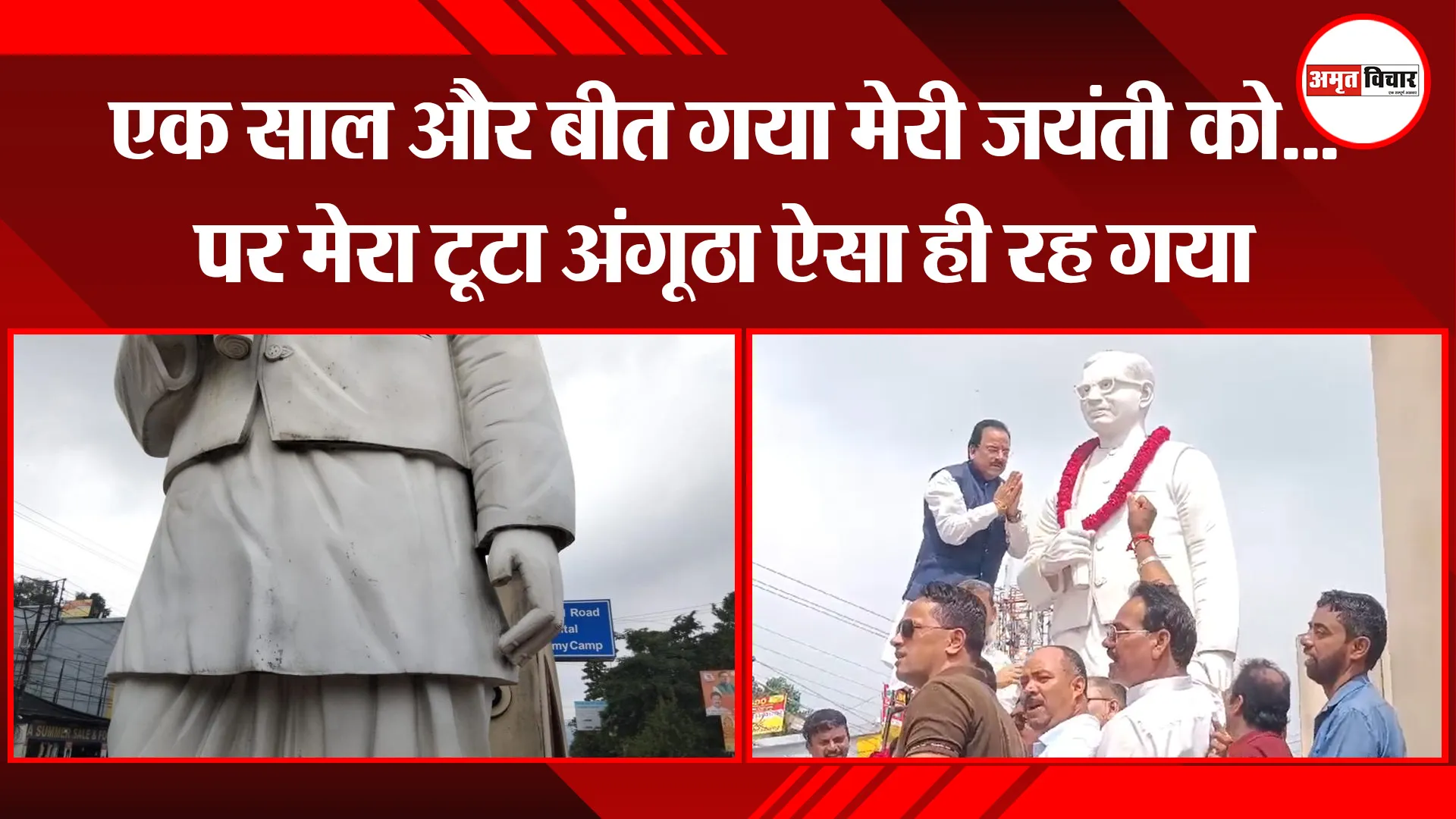 हल्द्वानी: एक साल और बीत गया मेरी जयंती को...पर मेरा टूटा अंगूठा ऐसा ही रह गया
