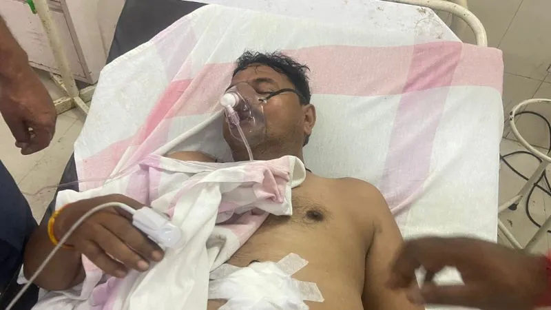 Unnao News: शराब दुकान के सेल्समैन को मारी गोली, 55 हजार रुपये लूटकर लुटेरे हो गए फरार, जांच में जुटी पुलिस