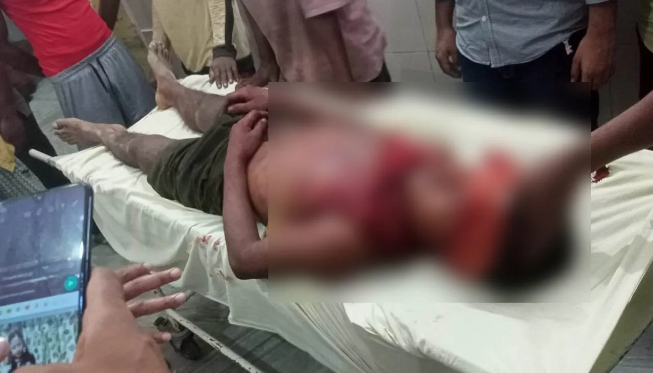 बरेली: निर्माणाधीन कुतुबखाना पुल पर बड़ा हादसा, शटरिंग खोलते समय नीचे गिरा मजदूर, हालत गंभीर