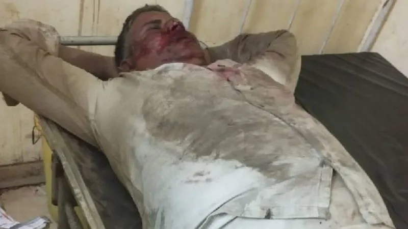 Kanpur News: बदमाशों ने हेड कांस्टबेल पर किया जानलेवा हमला, पैसे और मोबाइल लूट कर हो गए फरार, दोनों गिरफ्तार