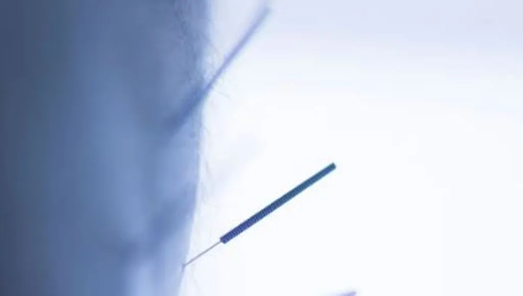 VIRAL NEWS: मां कर रही थी खेत में काम, मासूम बच्चे ने खेल-खेल में निगल लीं आठ सुइयां, आगे हुआ कुछ ऐसा... 