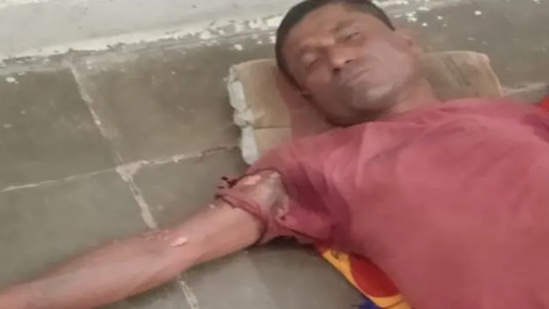 गोंडा : पैसा जमा कराने के बाद भी नहीं जोड़ा बिजली कनेक्शन, युवक ने छुआ ट्रांसफॉर्मर - झुलसा 