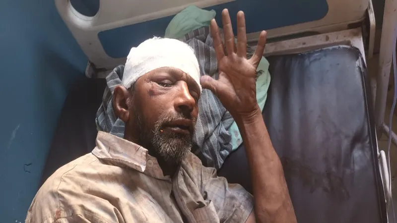 संभल : धारदार हथियार से हमला कर लूटा ई-रिक्शा व नकदी, घायल को अस्पताल के पास डालकर चले गये लुटेरे