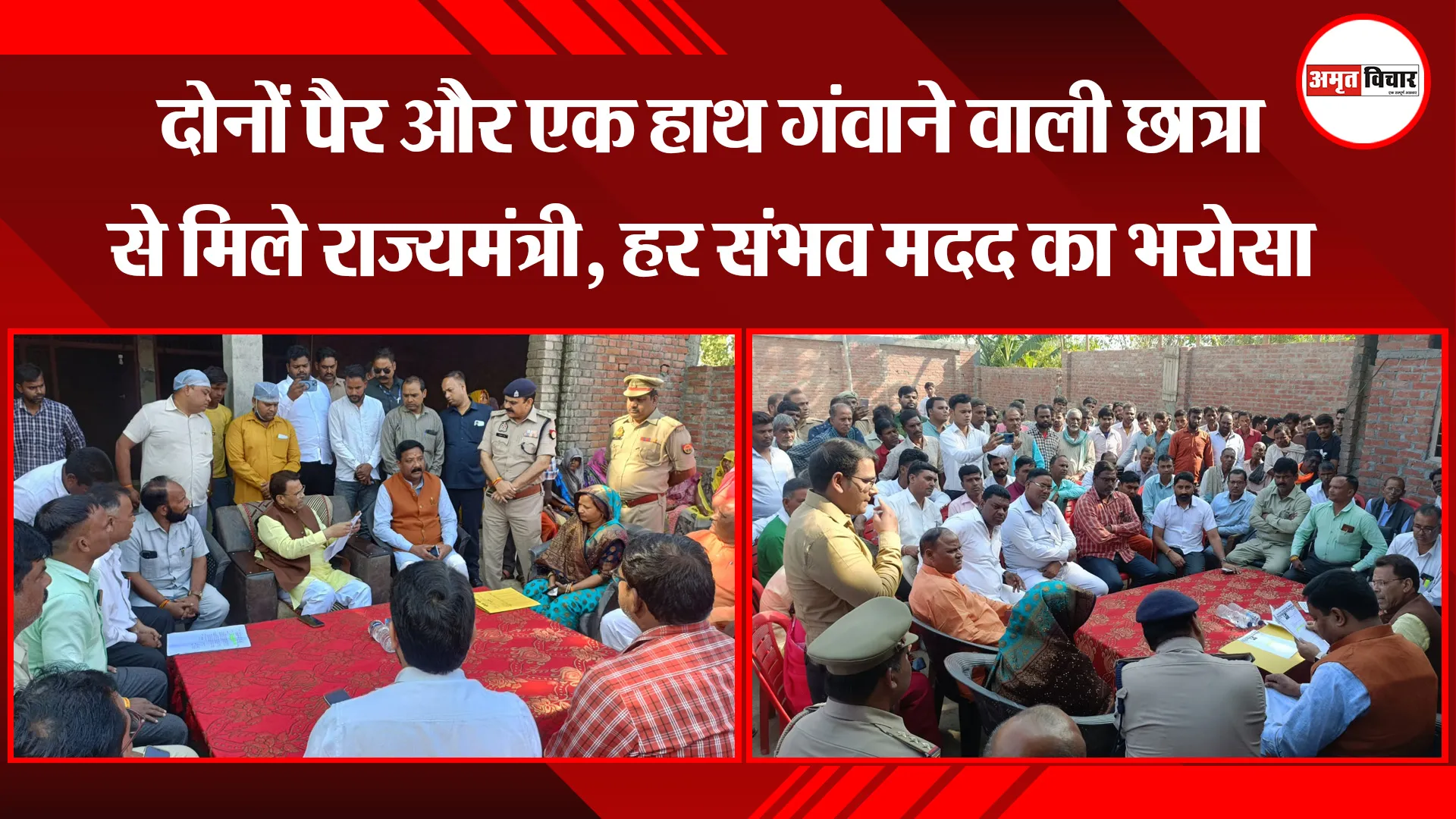 बरेली: दोनों पैर और एक हाथ गंवाने वाली छात्रा से मिले राज्यमंत्री, हर संभव मदद का भरोसा