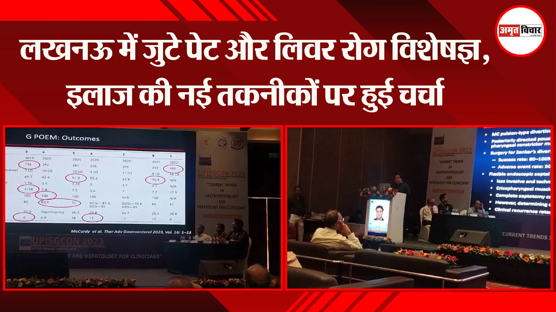 लखनऊ में जुटे पेट और लिवर रोग विशेषज्ञ, इलाज की नई तकनीकों पर हुई चर्चा