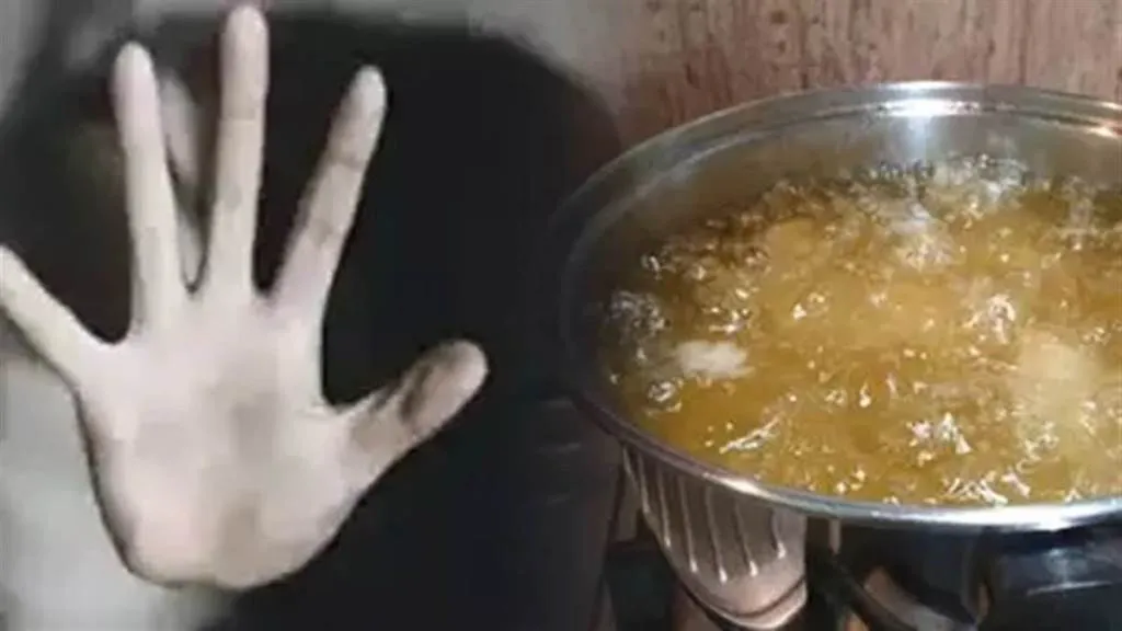 बदायूं: गर्म रोटी न मिलने पर बारातियों ने हलवाई पर फेंका खौलता हुआ तेल