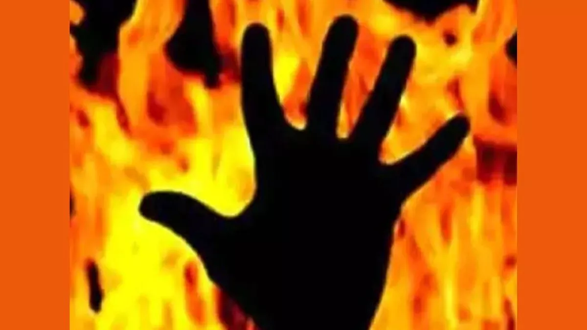 रामपुर: संदिग्ध परिस्थितियों में घर में लगी आग से झुलसा युवक, मौत
