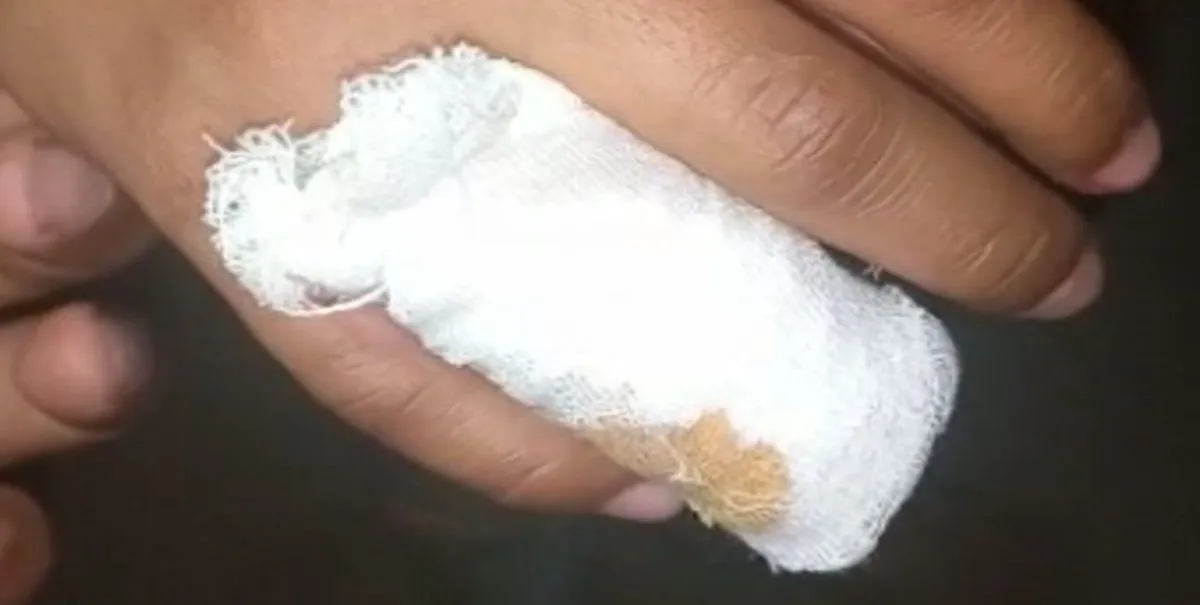 हल्द्वानी: गाना बजाने से रोका, दांत से काट कर अलग की अंगुली