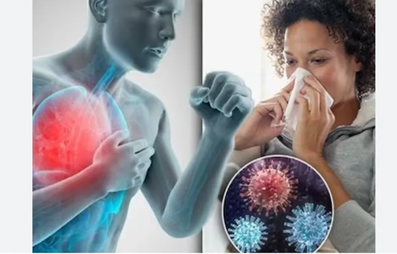 रुद्रपुर: जिले में निमोनिया और इन्फ्लूएंजा फ्लू को लेकर स्वास्थ्य विभाग अलर्ट