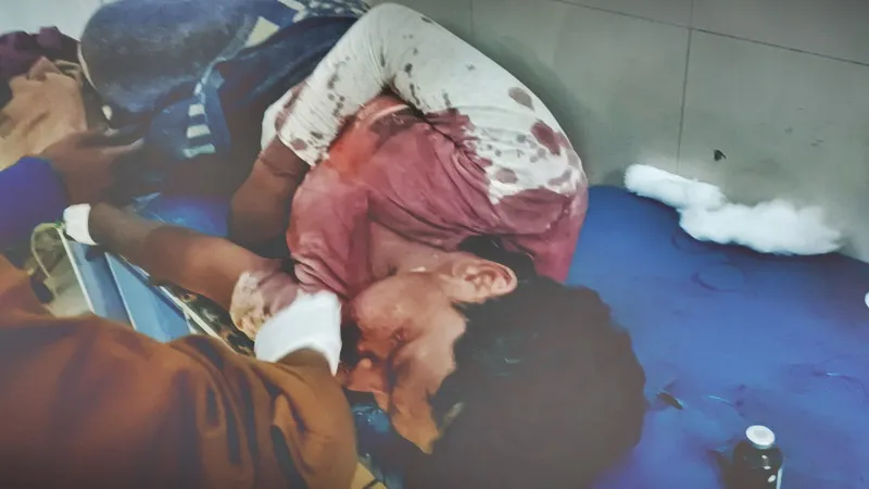 बहराइच: करछुला से हमला कर ग्रामीण को किया लहूलुहान, जिला अस्पताल में चल रहा इलाज