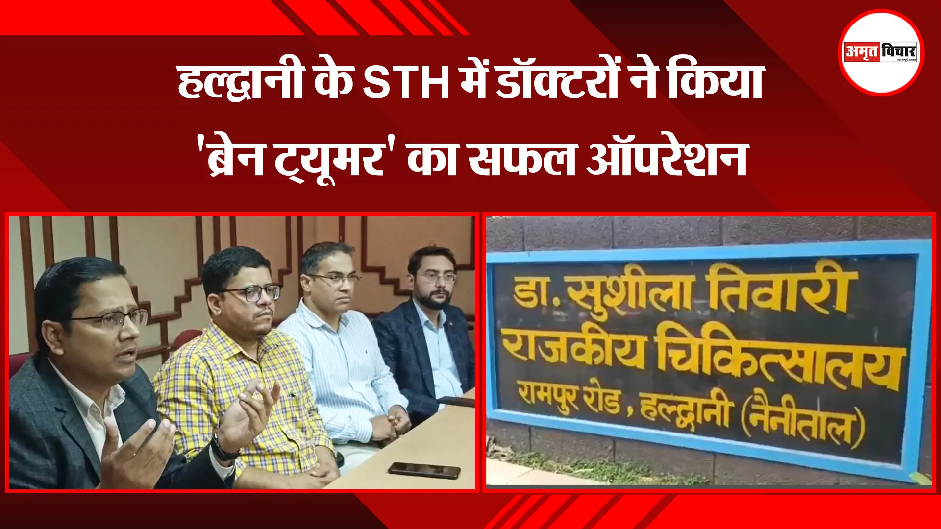 हल्द्वानी के STH में डॉक्टरों ने किया 'ब्रेन ट्यूमर' का सफल ऑपरेशन