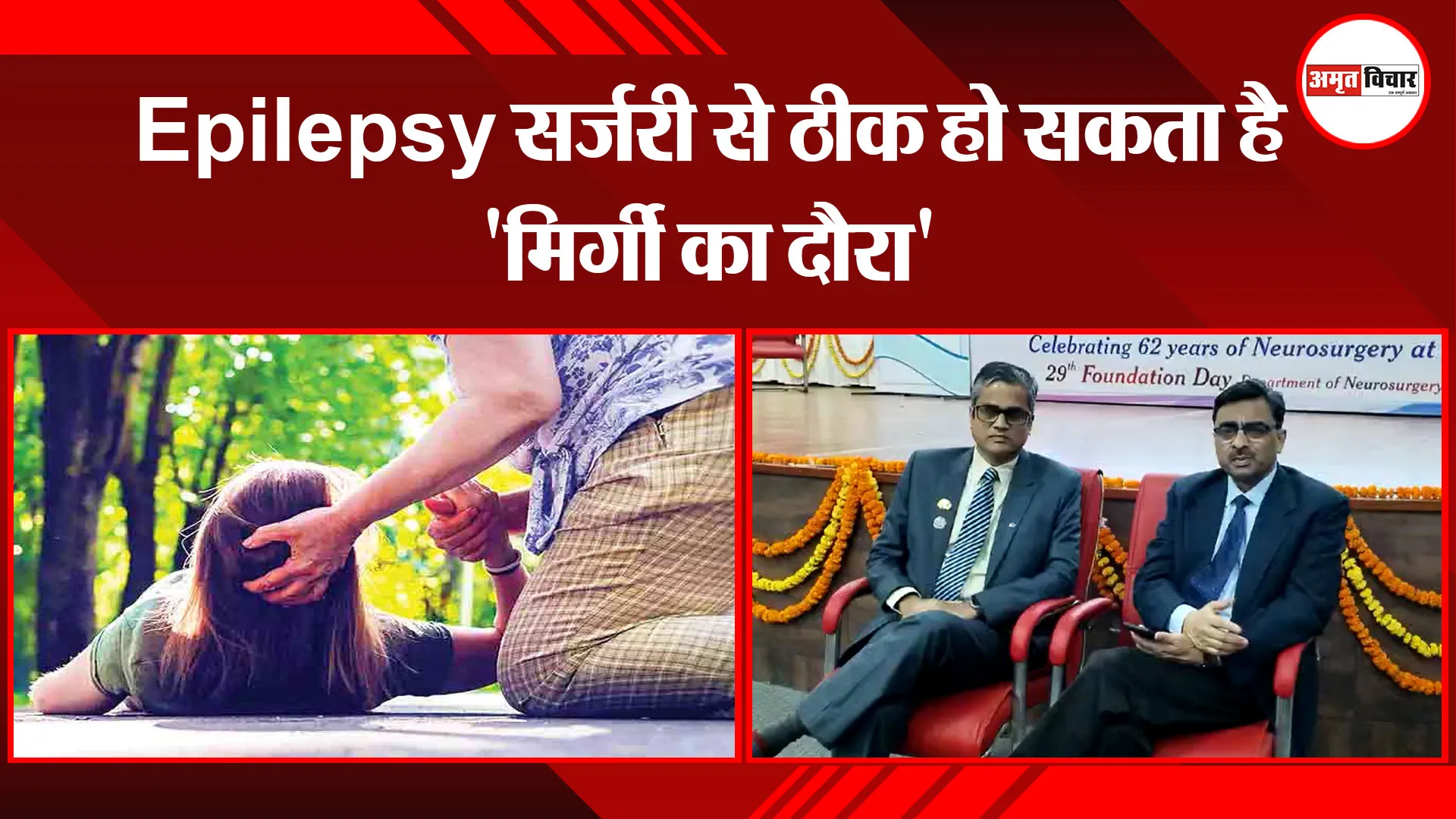 लखनऊ: Epilepsy सर्जरी से ठीक हो सकता है 'मिर्गी का दौरा'