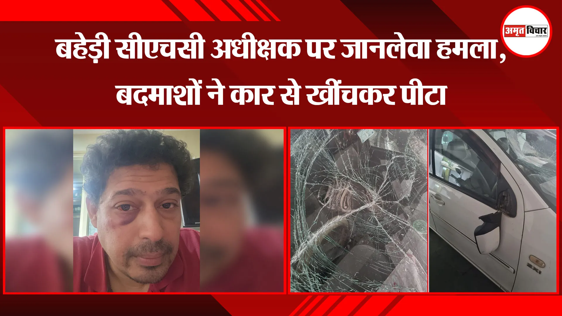 बरेली: बहेड़ी सीएचसी अधीक्षक पर जानलेवा हमला, बदमाशों ने कार से खींचकर पीटा