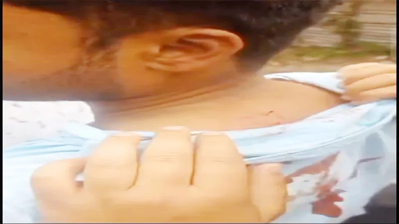 VIDEO: लखनऊ विश्वविद्यालय के न्यू कैंपस में छात्र पर जानलेवा हमला, दो छात्र गुटों में हुई जमकर मारपीट