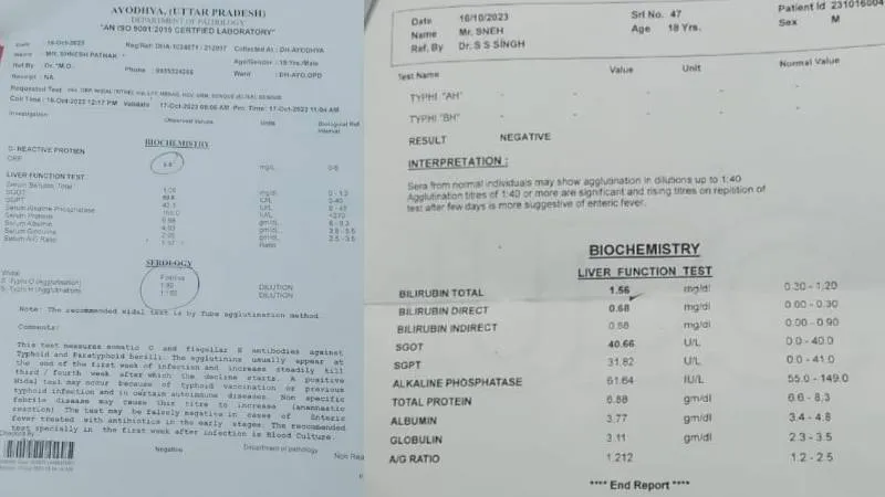 अयोध्या: किस मर्ज की दवा करे मरीज..., सरकारी व निजी पैथालॉजी की जांच में रिपोर्ट में अंतर