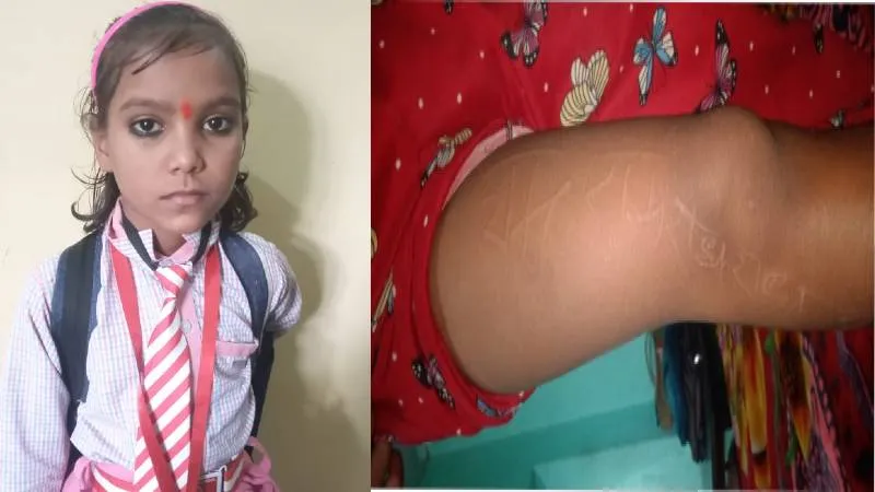 चमत्कार! राम-राम- राधे-राधे...हरदोई में बच्ची के शरीर पर उभरे देवी-देवताओं के नाम, लोगों बोले दैवी शक्ति 