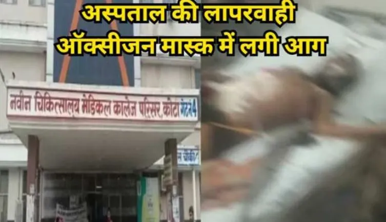 जामनगर: सरकारी अस्पताल की ICU में ऑक्सीजन मास्क में आग लगने से मरीज झुलसा, कारण स्पष्ट नहीं