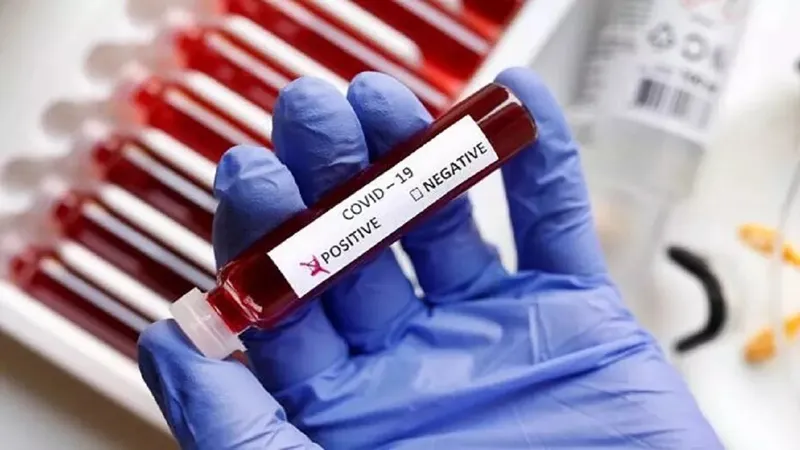 लखनऊ में कोरोना की दस्तक, महिला में हुई वायरस की पुष्टि, जीनोम सीक्वेसिंग के लिए KGMU भेजा गया सैंपल