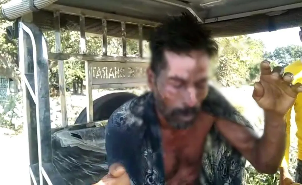 लखीमपुर खीरी: बेलरायां चीनी मिल में खौलते पानी में गिरने से मजदूर झुलसा