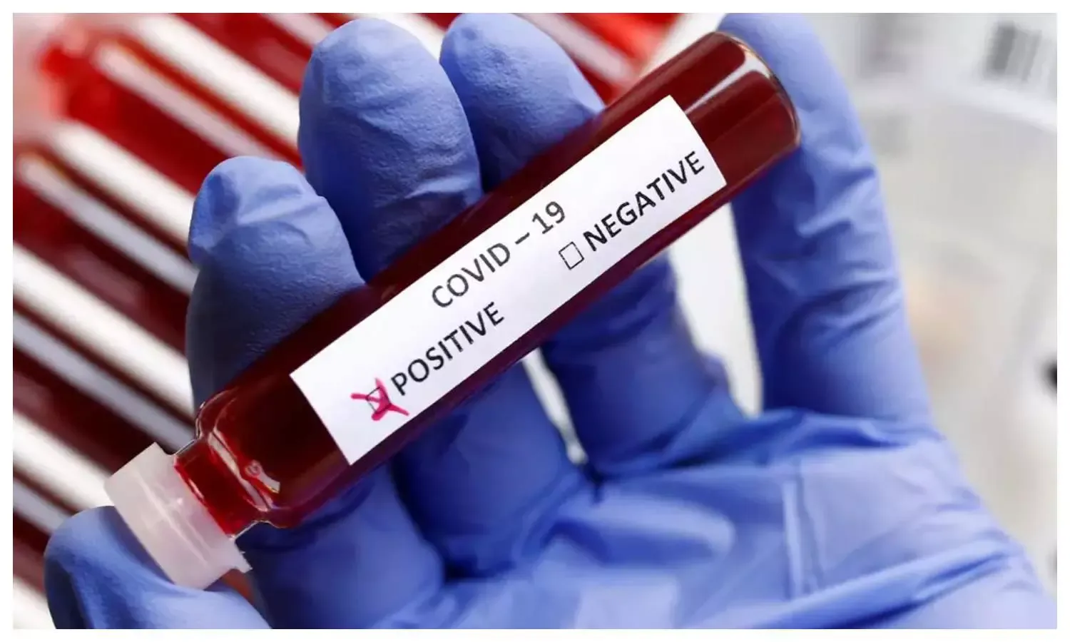 बरेली: कोविड सैंपल डंप करने के मामले में सीएमओ ने बैठाई जांच, पहले भी मामले उजागर हुए लेकिन कार्रवाई के नाम पर सिर्फ हुई खानापूरी