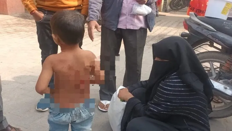 संभल: मां के साथ जा रहे बालक को कुत्तों ने किया जख्मी