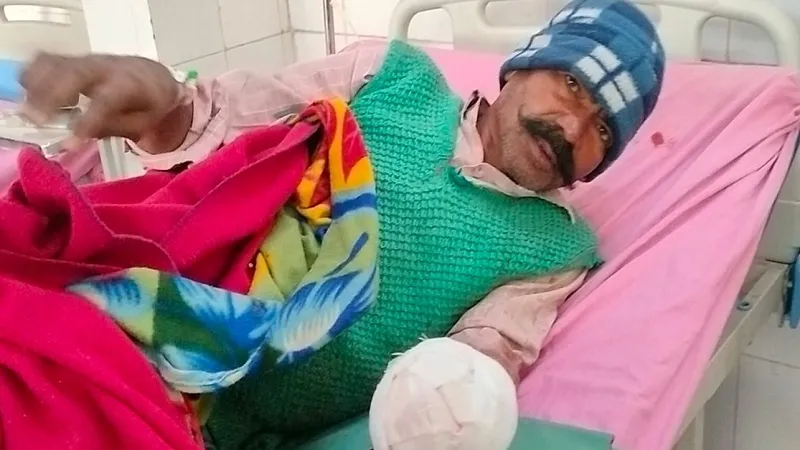 मुरादाबाद : ट्रेन की चपेट में आने से किसान का हाथ कटा