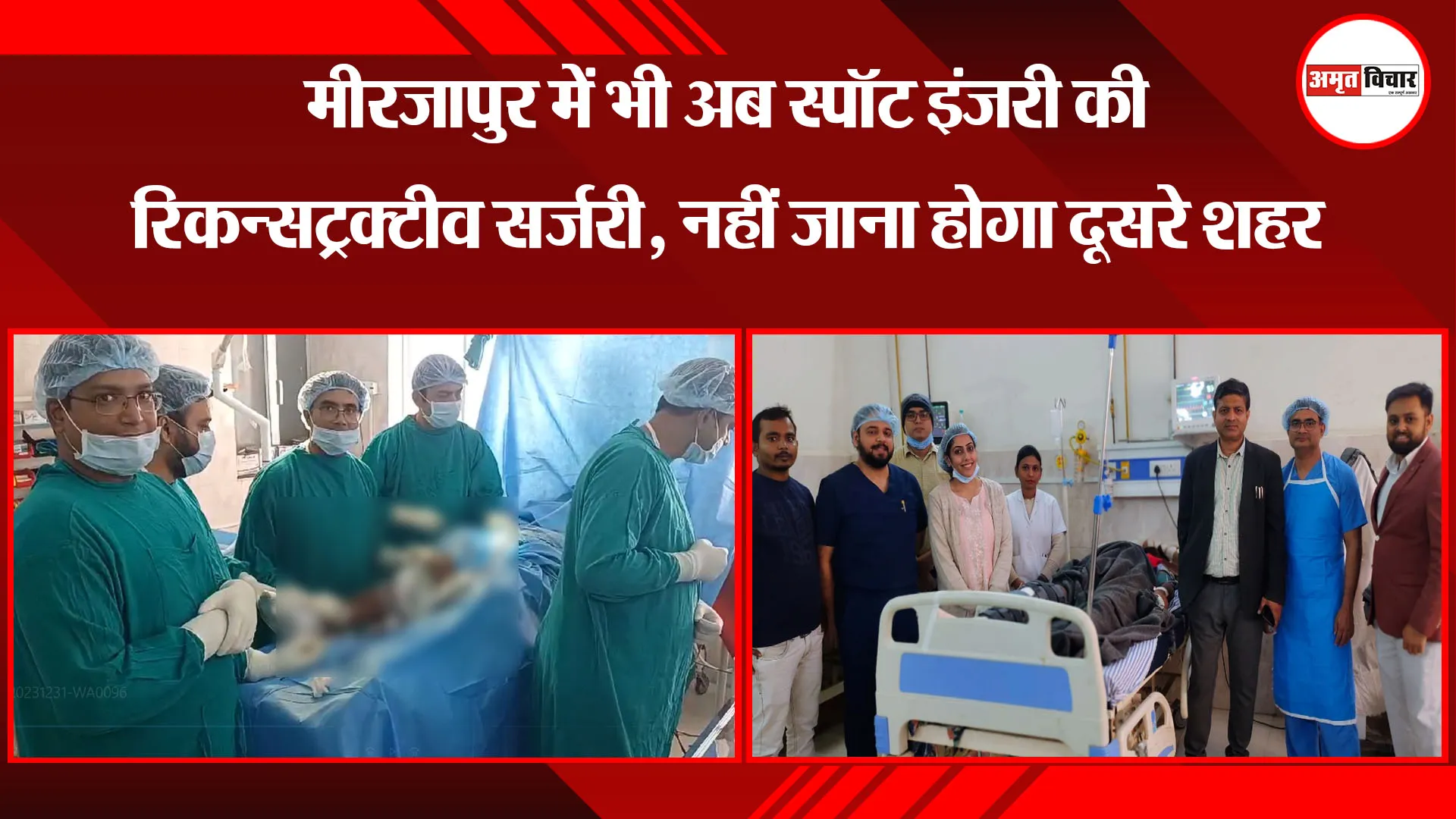 मीरजापुर में भी अब स्पॉट इंजरी की रिकन्सट्रक्टीव सर्जरी, नहीं जाना होगा दूसरे शहर 