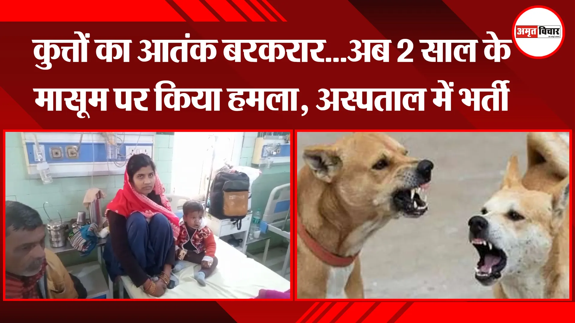 बरेली: कुत्तों का आतंक बरकरार...अब 2 साल के मासूम पर किया हमला, अस्पताल में भर्ती
