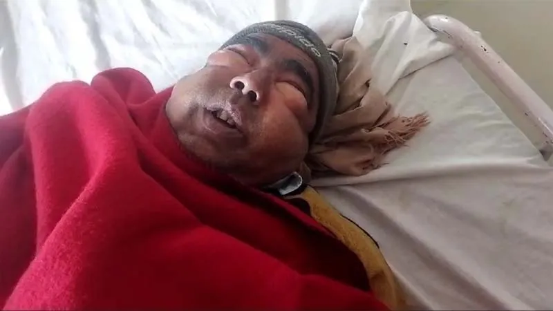 हरदोई: दर्द से कराहते हुए अधेड़ बोला- पुलिस ने इतना मारा कि बहुत दर्द हो रहा है... VIDEO जारी किया तो POLICE महकमे में मच गया हड़कंप, जानें मामला...