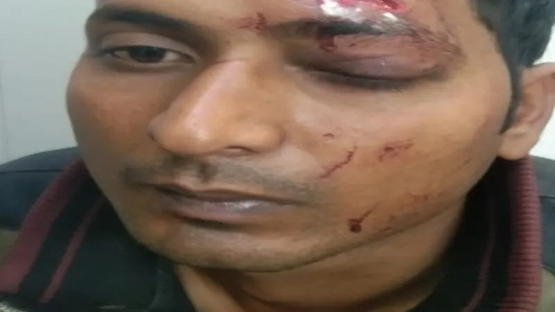 बहराइच : सुबह सीओ और थानाध्यक्ष को सुरक्षा के लिए दिया पत्र, रात में हो गया हमला