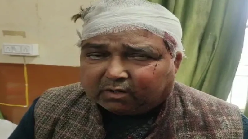 शाहाबाद में सभासद पर जानलेवा हमला, सरकारी जमीन कब्जाने वाले दबंगों ने जमकर किया बवाल  