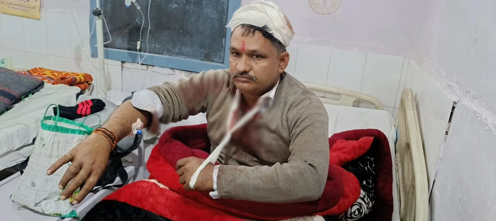 बरेली: गाली देने का विरोध करना पड़ा भारी, सपा नेता पर जानलेवा हमला, अस्पताल में भर्ती