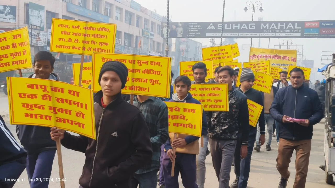 बरेली: मुख्य चिकित्साधिकारी ने कुष्ठ रोगियों के प्रति भेदभाव न करने की दिलाई शपथ ,निकाली जागरूकता रैली