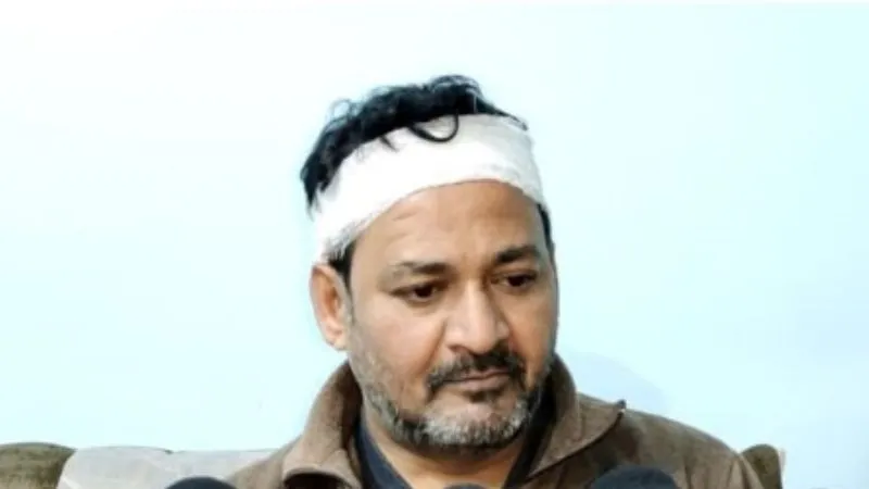  Etawah News: ब्रेक डांस झूले की एक ट्रॉली टूटी, युवक घायल, SDM बोले- जांच के बाद कार्यवाही की जाएगी