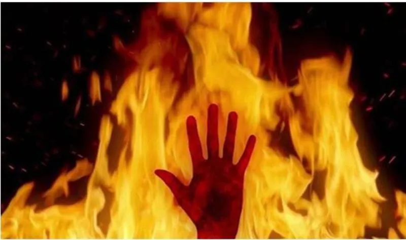 सितारगंज: झोपड़ी में आग लगाकर वृद्ध को जिंदा जलाने का प्रयास