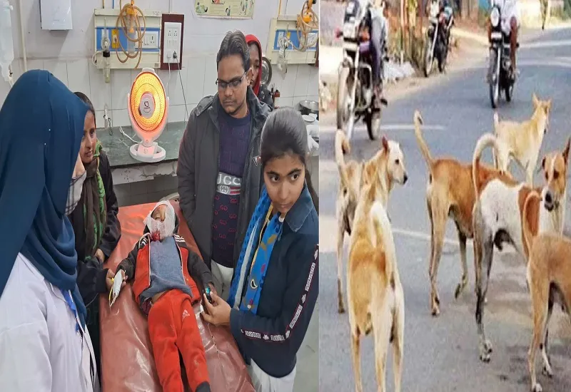 रामपुर: तीन साल के मासूम को कुत्तों ने नोचा, सर्जरी कर लगाने पड़े टांके