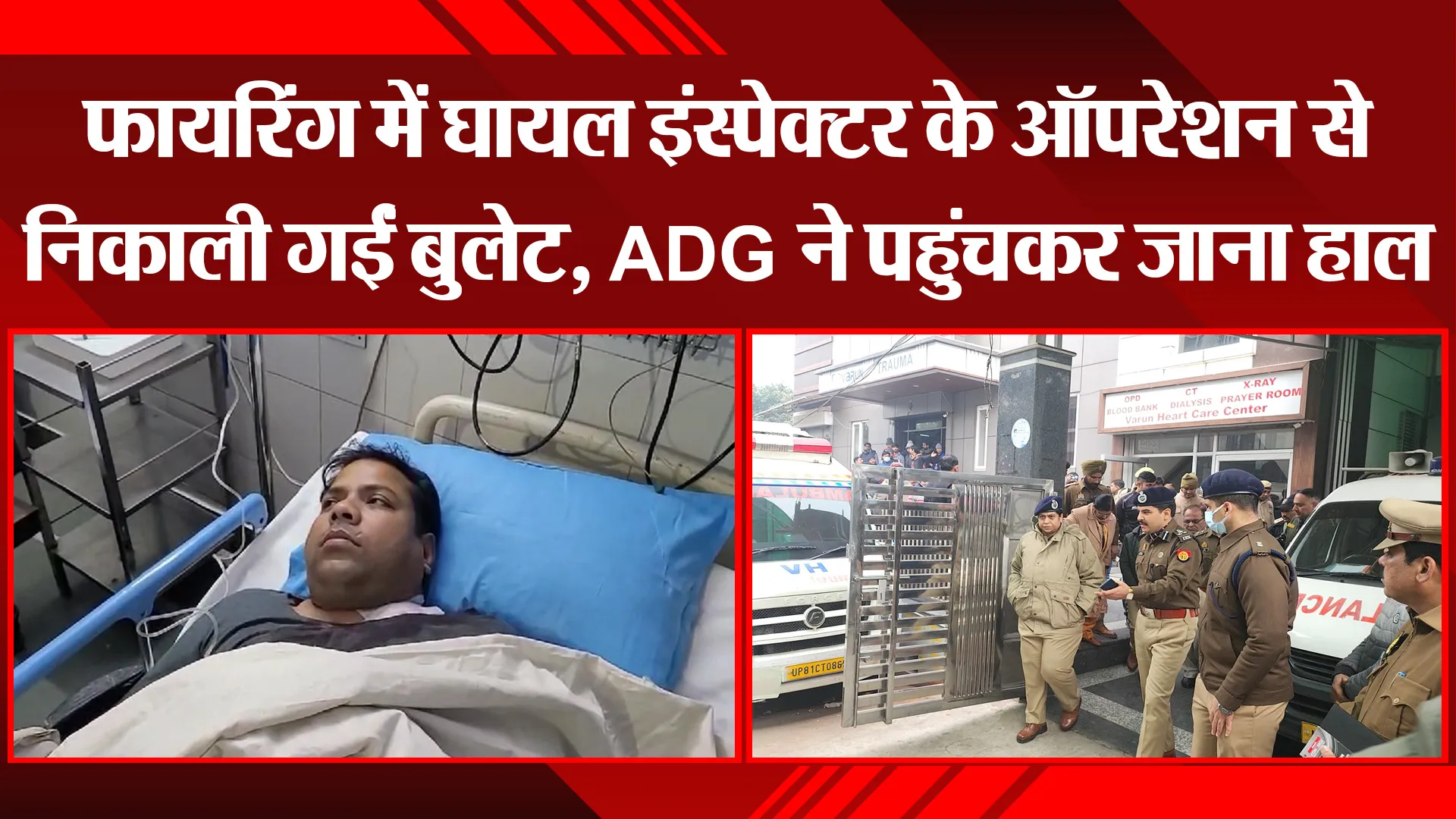कासगंज: फायरिंग में घायल इंस्पेक्टर के ऑपरेशन से निकाली गईं बुलेट, ADG ने पहुंचकर जाना हाल