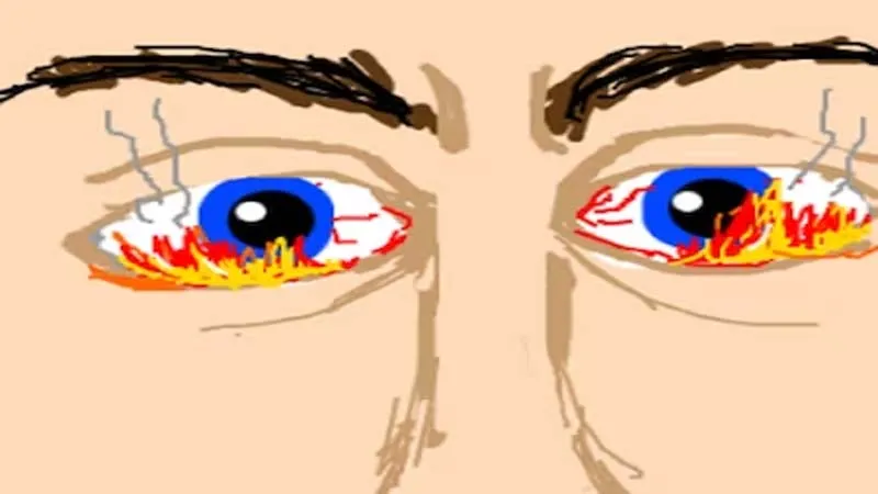 बदमाशों ने सर्राफा व्यापारी को असलहा दिखाकर की मारपीट, विरोध किया तो आंख में झोंक दी मिर्ची, बैग लेकर हुए फरार