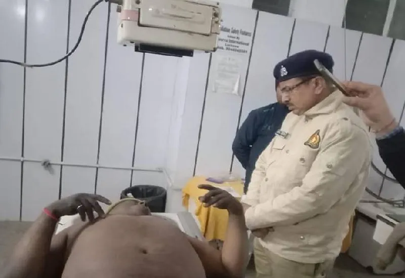 मुरादाबाद : गोलियों की तड़तड़ाहट, लूट की कोशिश नाकाम...गोली लगने से अंडा व्यापारी घायल