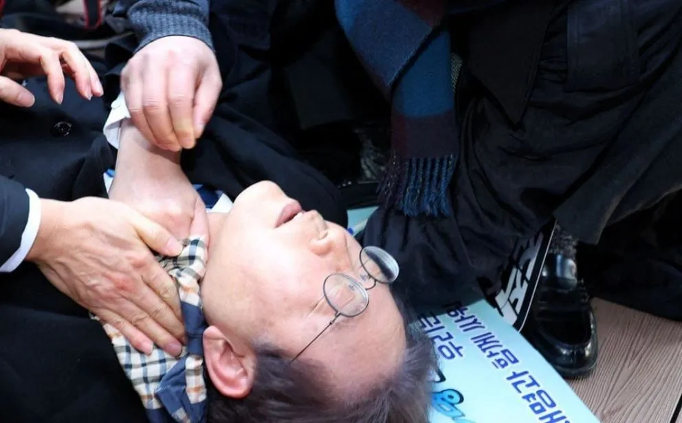 दक्षिण कोरिया के विपक्ष के नेता ली जे म्युंग पर अज्ञात व्यक्ति ने किया हमला, गर्दन पर चाकू से किया वार 